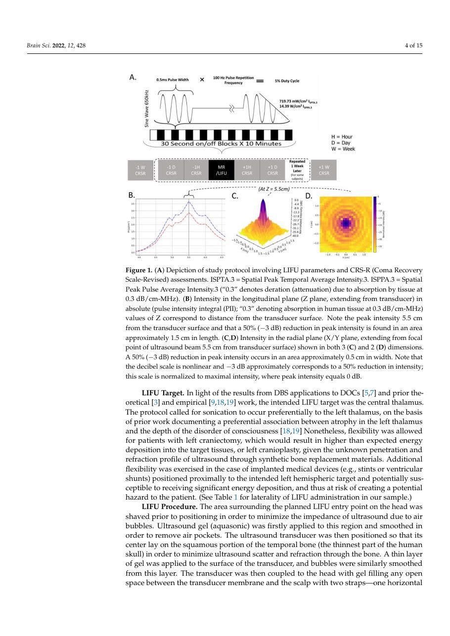 Figure showing neuronavigation-guided thalamic targeting
