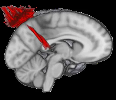 Research preview
