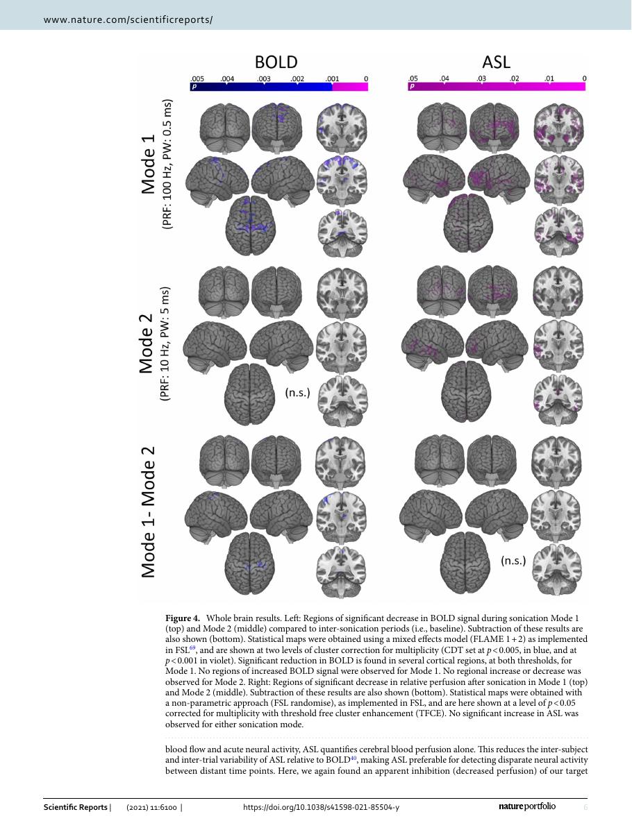 Figure showing delayed perfusion effects