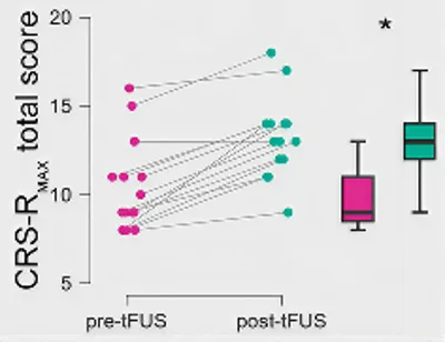 Research preview