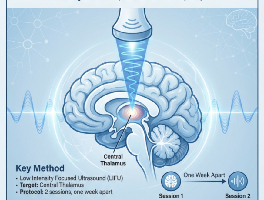Ultrasonic Thalamic Stimulation in Chronic Disorders of Consciousness