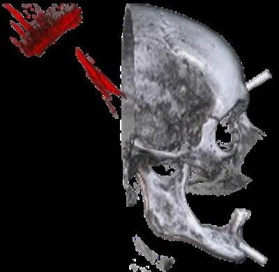 Research preview