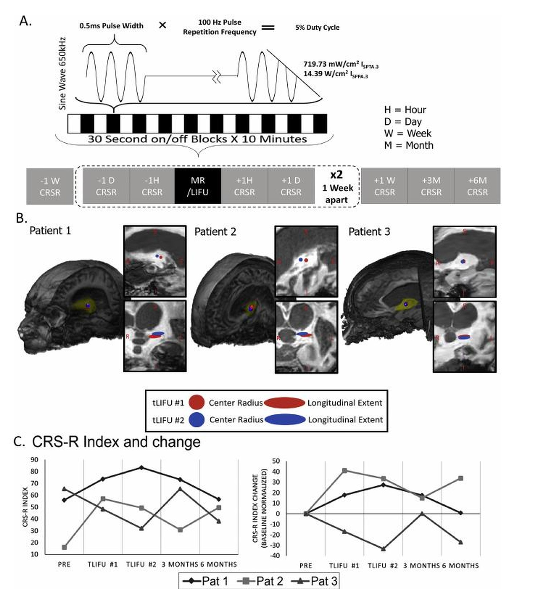 Protocol, patient targeting, and CRS-R trajectories