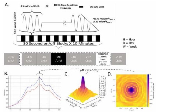 Study protocol and ultrasound beam intensity profiles