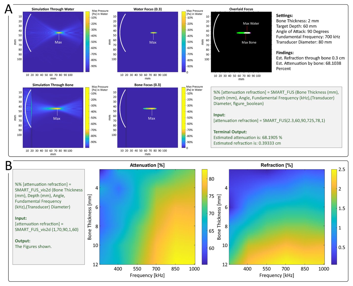 Primary graphical outputs of the SMART FUS toolbox